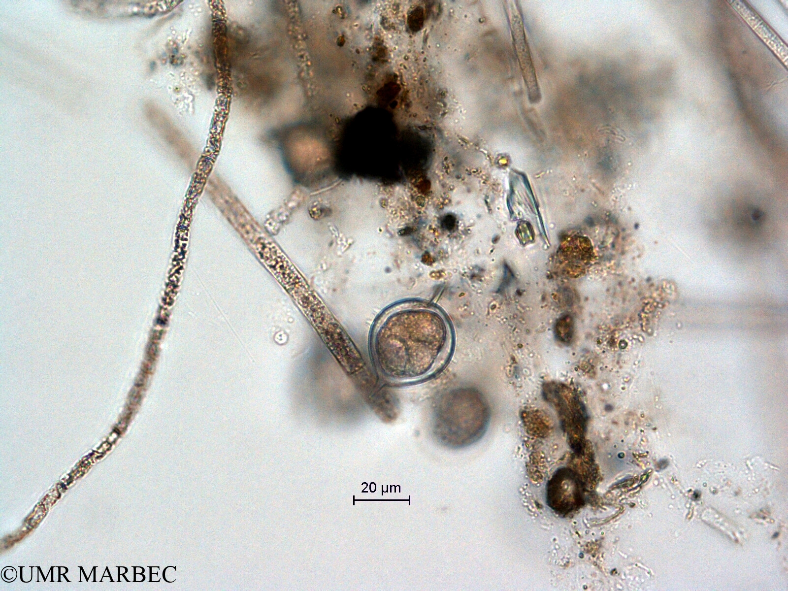 phyto/Scattered_Islands/all/COMMA April 2011/Protoperidinium cassum (ancien Protoperidinium sp2 recomposé -2)(copy).jpg